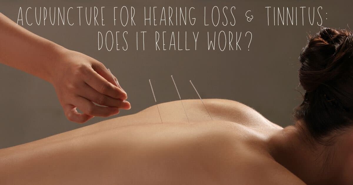 acupuncture poster