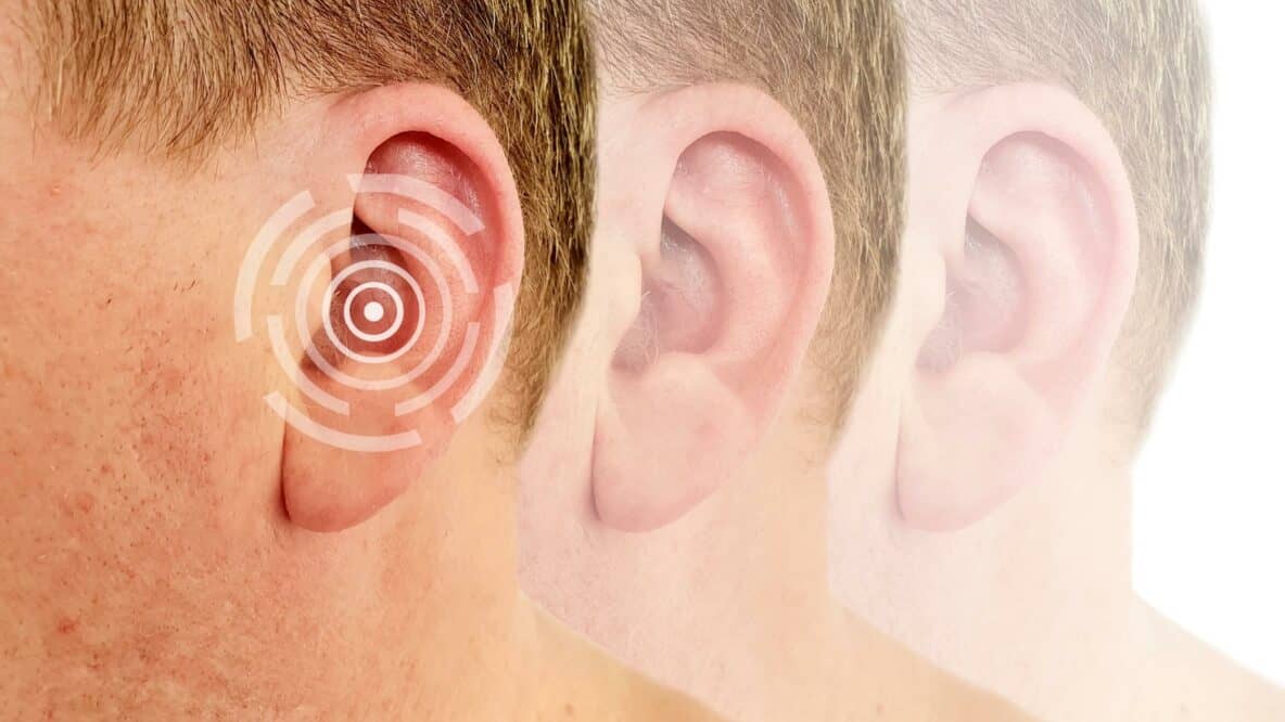 Strange Causes of Hearing Loss  